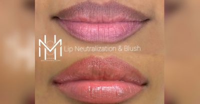 Permanent Makeup at Skin masters london for a Flawless Look