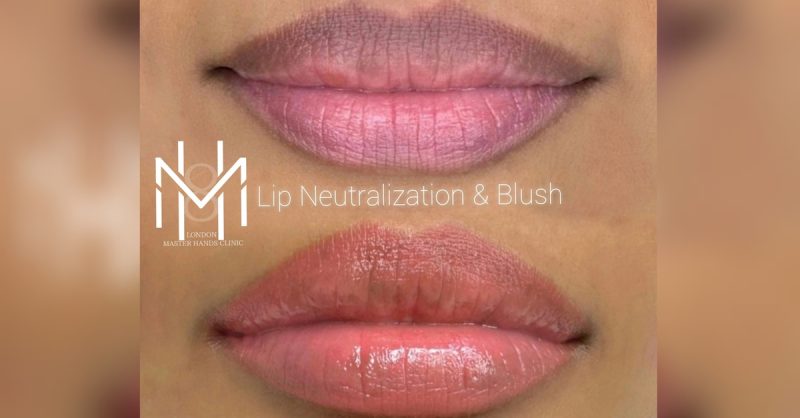 Permanent Makeup at Skin masters london for a Flawless Look