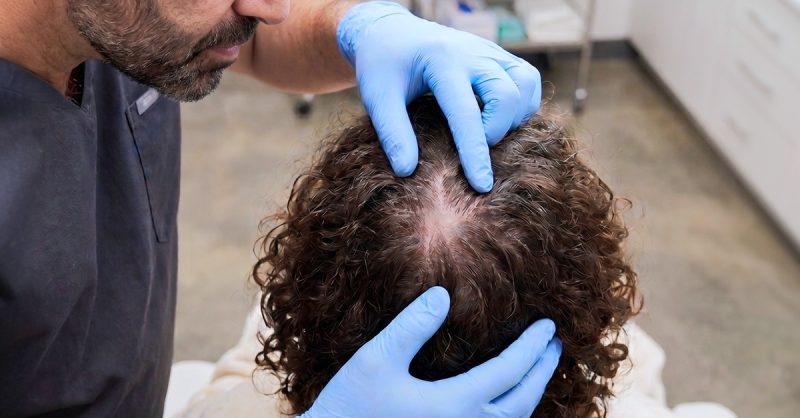 PRP Hair Restoration Sessions at Diamed London Clinic