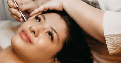 1 or 3 Sessions of Dermapen Microneedling at London Ladies Hair And Beauty Clinic