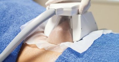 Summer-Ready Cryo 3D Lipo Treatments at Bliss Beauty Spa