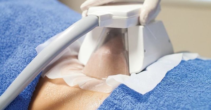 Summer-Ready Cryo 3D Lipo Treatments at Bliss Beauty Spa