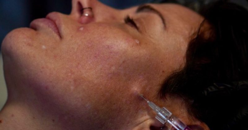 Polynucleotide Treatment at The Aesthetics Lounge for Radiant Skin