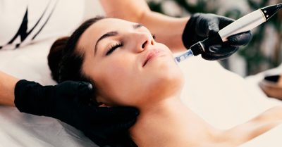 Microneedling Sessions at Skin Remedy Clinic in London