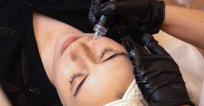 Blemish Clarifying Facial Treatment at Avant Skincare