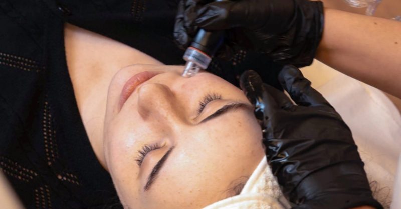 Blemish Clarifying Facial Treatment at Avant Skincare