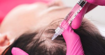 PRP Platelet Rich Plasma Treatment at London Body Clinic