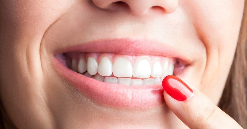 Laser Teeth Whitening for a Brighter Smile at BodyWorx
