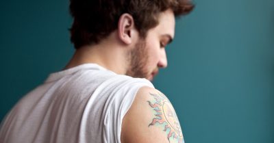 Laser Tattoo Removal Sessions at Pure Skin Tattoo Removal