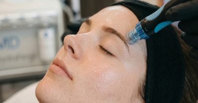 HydraFacial Treatments at Jelnar’s clinic for Radiant Skin