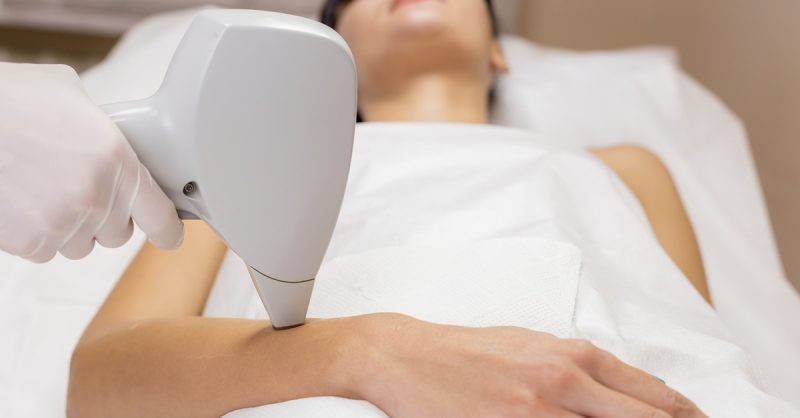 Six IPL Laser Hair Removal Sessions at Fami Beauty