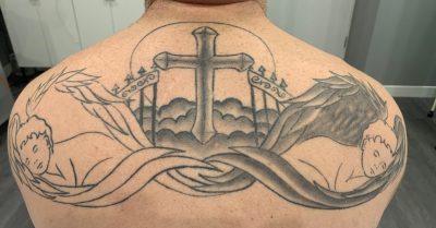 Tattoo Removal Session at Omega Laser Aesthetics