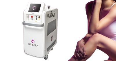 Laser Hair Removal at London Skin Wellness House 1