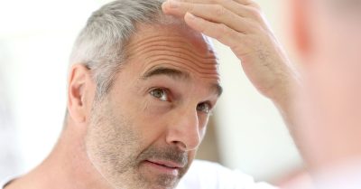 Hair Restoration Treatments at Pharma Aesthetics in London