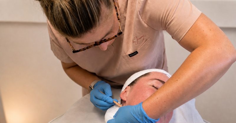 Rejuvenating Microneedling Facial at ByJessie Nurse Led Aesthetics