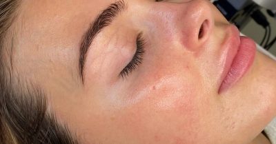 HydraFacial at Lash hq for a Refreshing Skin Treatment