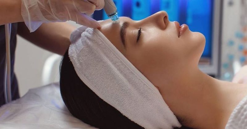 Revitalize Your Skin with Micro-Needling at ROOP