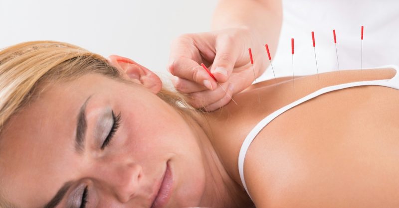 Revitalize with Acupuncture at Health