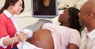 Premium 4D Fetal Scan at Window to the Womb, Alton