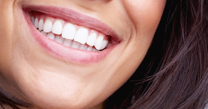 Express Whitening Treatment at Beauty Enhance Limited