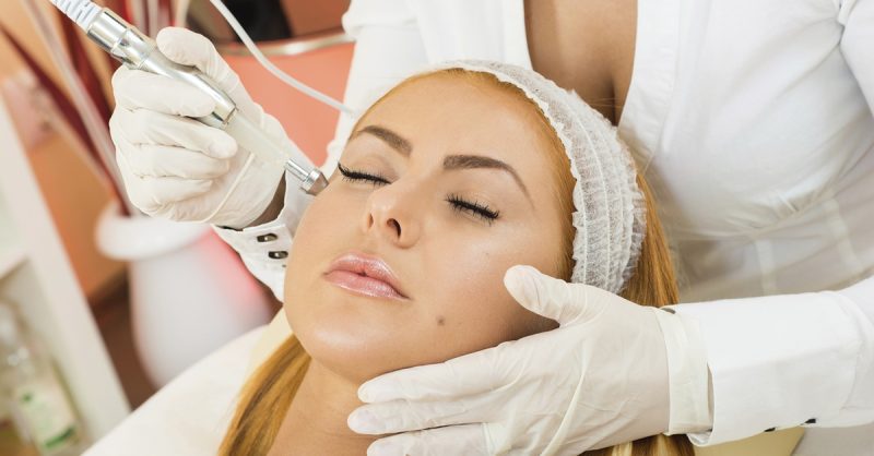 30-Minute Microdermabrasion Session at Yorkshire Laser and Aesthetics