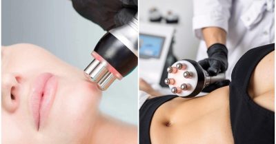 Skin Tightening & Firming Treatment at Altaesthetics
