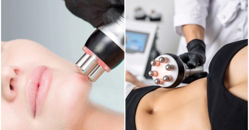 Skin Tightening & Firming Treatment at Altaesthetics