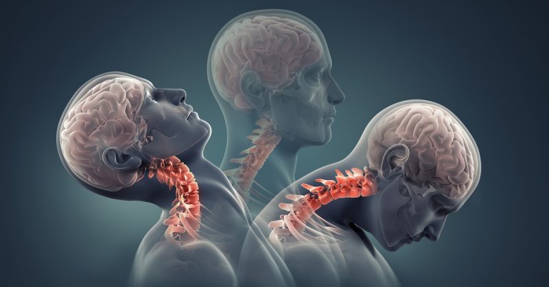 Expert Whiplash & Neck Pain Relief at Raymond Nash