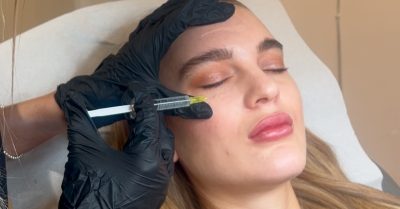 Revitalize Your Eyes with Dark Circle Treatment at The Nordic Skin Clinic