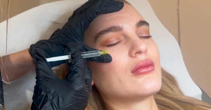 Revitalize Your Eyes with Dark Circle Treatment at The Nordic Skin Clinic