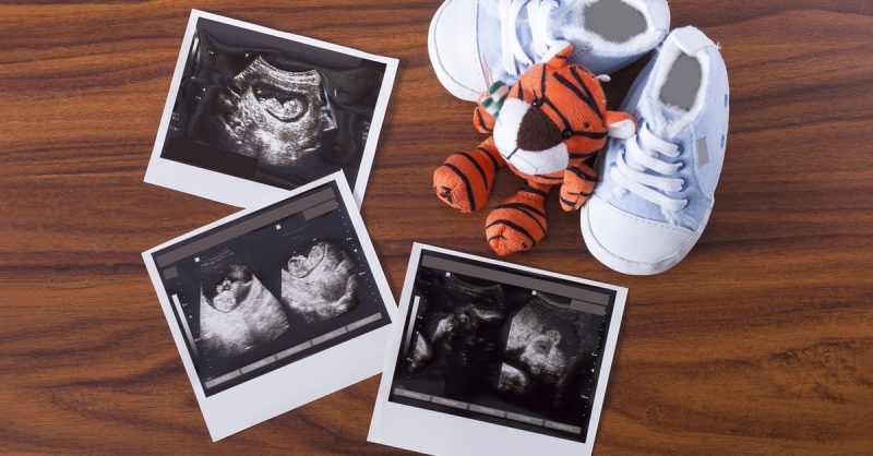 Conception Support Packages with Ultrasound at Reliable Scan