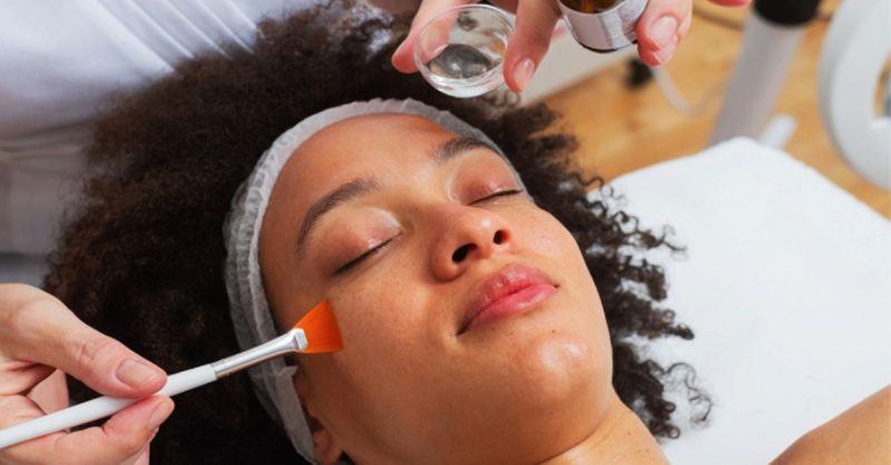 Revitalize Your Skin with a Glycolic Peel at Regains Beauty & Aesthetics