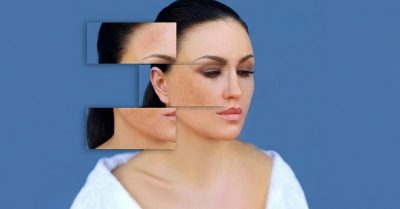 Revitalize Your Skin with HydraFacial at Cheshire Aesthetics & Beauty Training Academy