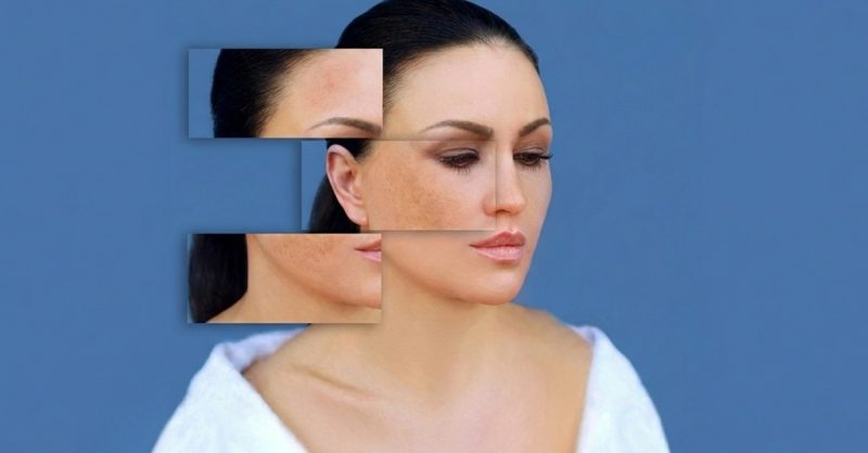 Revitalize Your Skin with HydraFacial at Cheshire Aesthetics & Beauty Training Academy