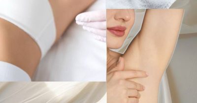 6 IPL Hair Removal Sessions at Beauty Beneath Salon