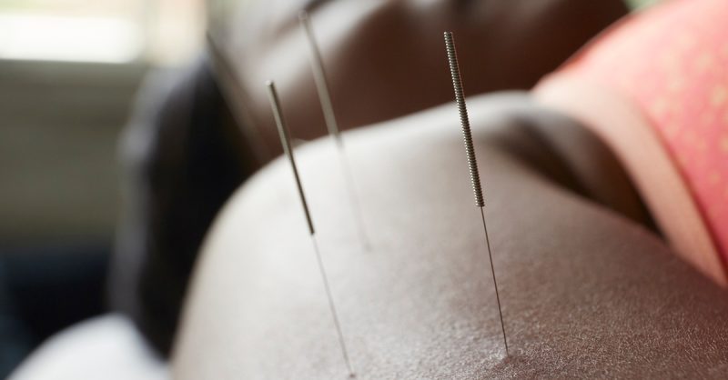 Acupuncture or Cupping Treatment at Meridian Movement