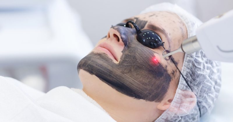 Revitalize Your Skin with Carbon Facial at Forever Face Clinic