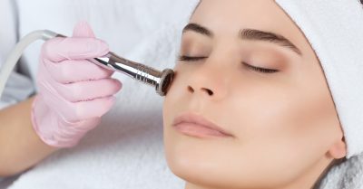 Microdermabrasion or Microneedling Session at Relax Beauty