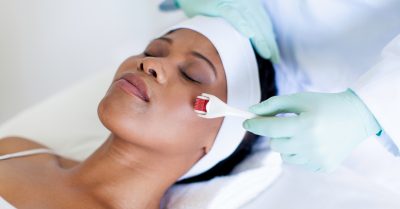 Revitalize Your Skin with Microneedling at Skin Cosmedics