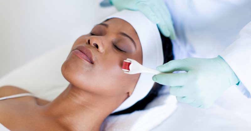 Revitalize Your Skin with Microneedling at Skin Cosmedics