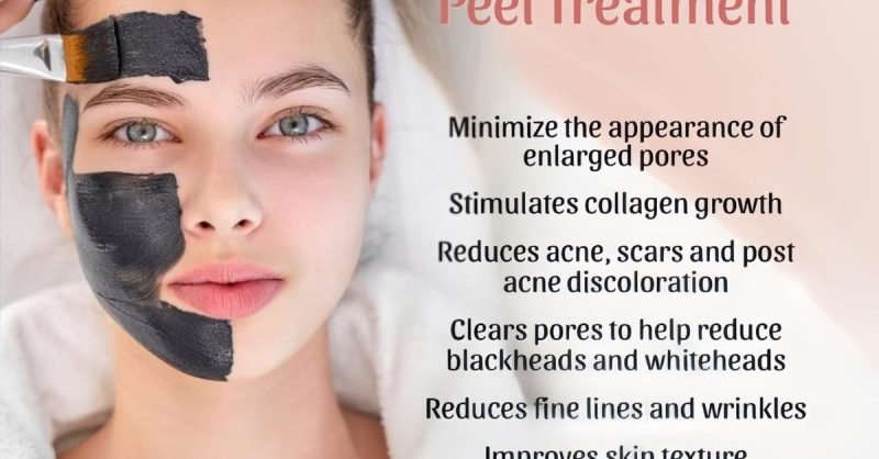 Premium Carbon Laser Peels with Facial Massage at Wonderland by Sona