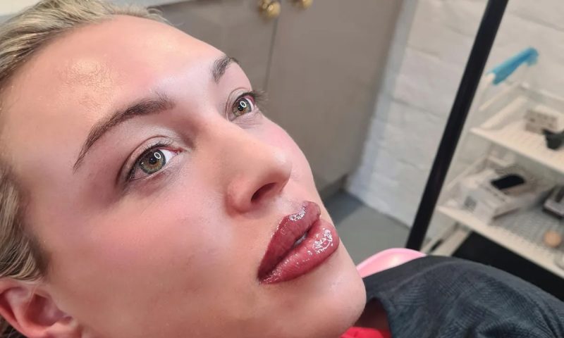 Dermal Lip Filler with Consultation at The Pixie Parlour