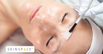 Glycolic Glow Peel at SkinSpaceUK for Spring Skin Renewal