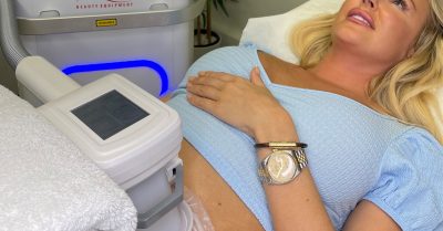 Cryogenic Lipolysis Treatment at Moda Donna Beauty Clinic - Canary Wharf