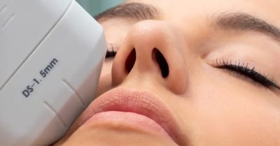 Revitalize with HIFU Treatments at North London Aesthetic Clinic