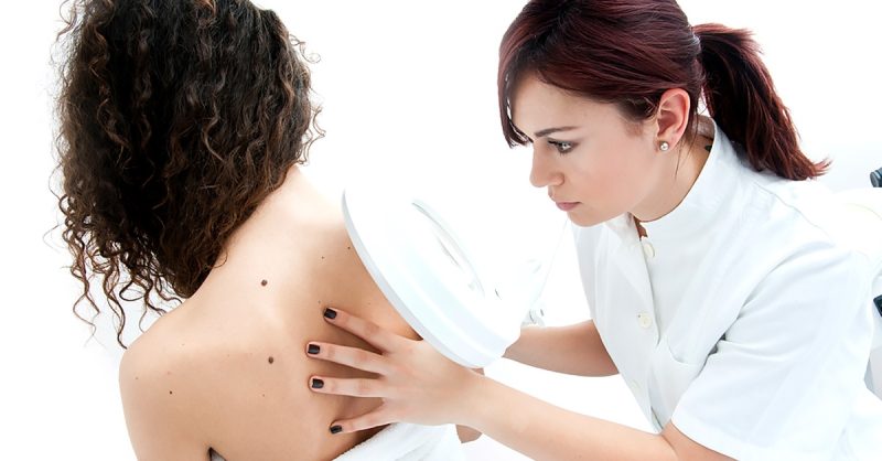 Up to 10 Skin Tag and Blood Spot Removal Sessions at Beauty Is Yours