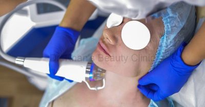 45-Minute RF Gold Microneedling with Vitamin Boost at Dr Khans Beauty Clinic