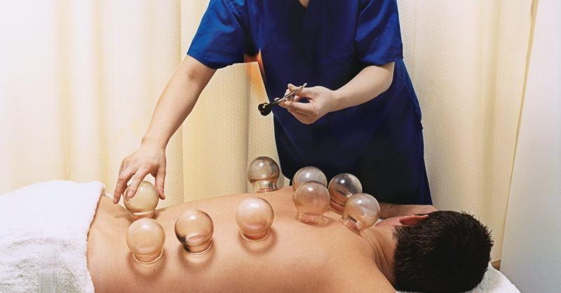 Deep Tissue Chinese Cupping Sessions at AcupointCare Wellness Centre