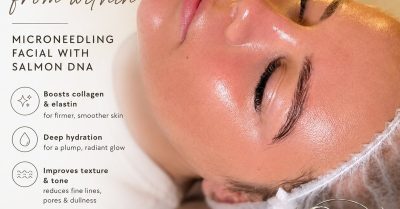 Medical Microneedling for Skin Rejuvenation at Glow By Jade Aesthetics