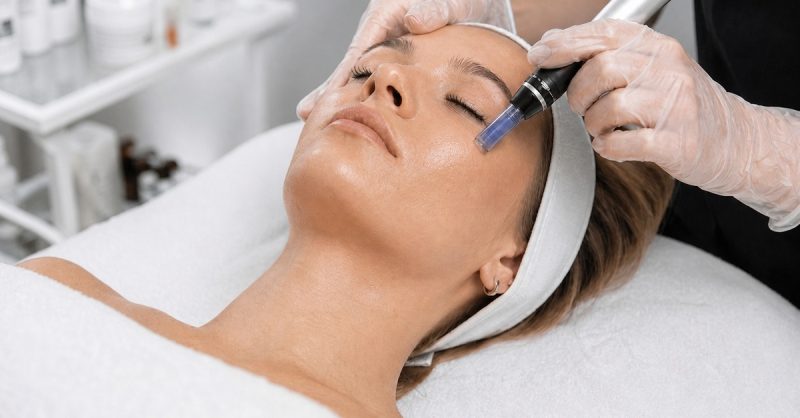 Dermapen Microneedling at Aesthetic and beauty consultants